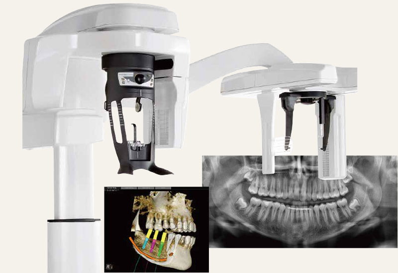 歯科用CT