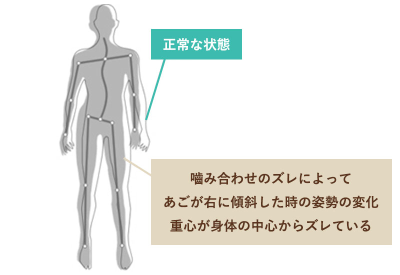 噛み合わせの不具合